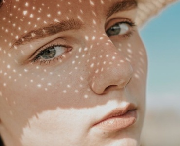 Estate senza arrossamenti: come proteggere e coccolare la pelle più sensibile al sole
