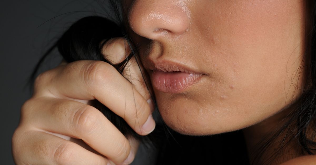 Pelle lucida? 10 rimedi efficaci per controllare il sebo e ritrovare un viso fresco