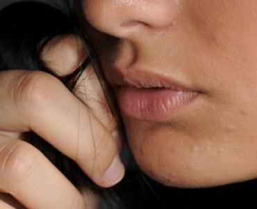 Pelle lucida? 10 rimedi efficaci per controllare il sebo e ritrovare un viso fresco