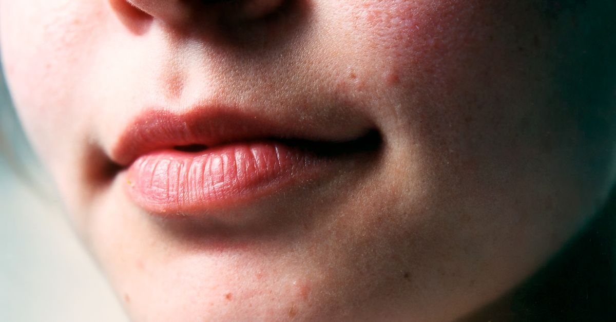 Labbra Morbide Tutto l’Anno: Il Segreto di un Balsamo Ultra-Nutriente