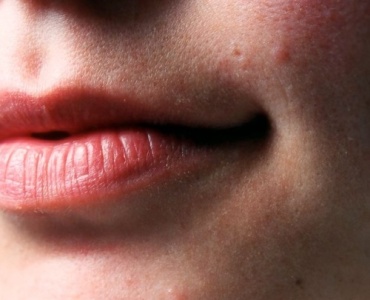 Labbra Morbide Tutto l’Anno: Il Segreto di un Balsamo Ultra-Nutriente